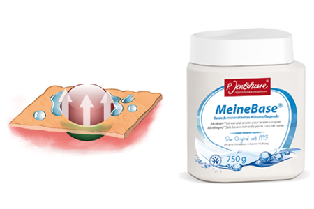 Ontgiften 3 ontzuringsproducten meinebase